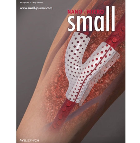 혈관외벽 서포트 연구 논문, Small journal cover 선정 (2021.05)